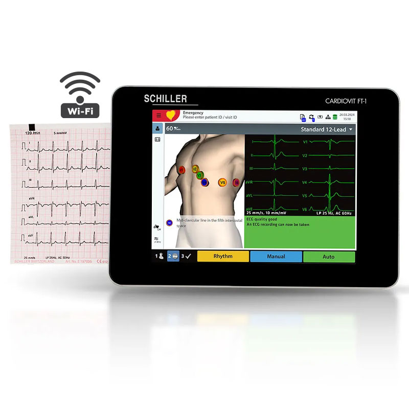 Cardiovit FT-1 ECG/EKG with interpretation.