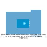 EXTREMITY SURGICAL DRAPE 87INX128.5IN ARMBOARD WIDTH 106IN CIRCULAR FENESTRATION 2.5IN REINFORCED 30.5INX42IN ANESTHESIA