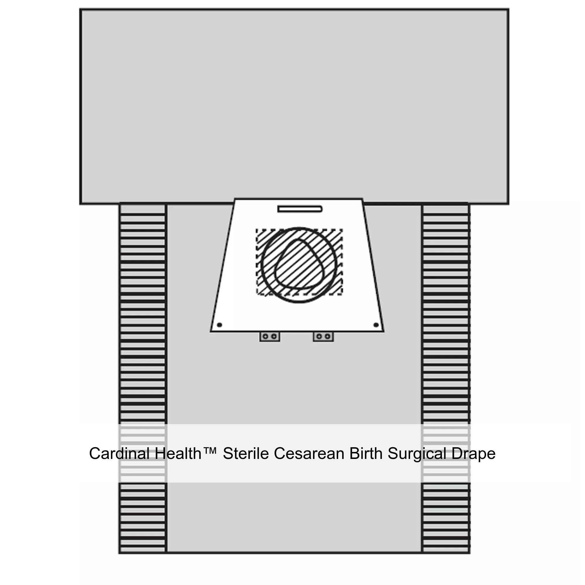 Cardinal Health™ Sterile Cesarean Birth Surgical Drape, 77 x 122IN